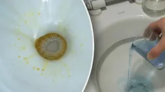 Le macchie gialle spariranno all’istante: basta versare questo rimedio casalingo nel WC